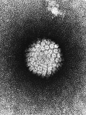 English: Pathology: EM: Papilloma Virus (HPV) ... English: Pathology: EM: Papilloma Virus (HPV) ...