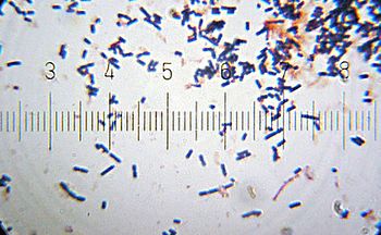 English: Lactobacillus acidophilus from a comm... English: Lactobacillus acidophilus from a comm...