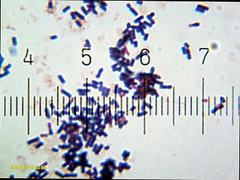 English: Lactobacillus acidophilus from a comm... English: Lactobacillus acidophilus from a comm...