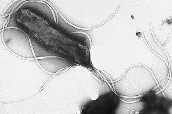 Electron micrograph of H. pylori possessing mu... Electron micrograph of H. pylori possessing mu...