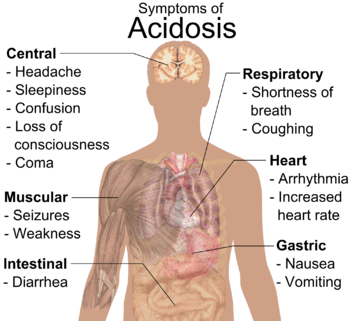 English: General symptoms of acidosis. (See al... English: General symptoms of acidosis. (See al...